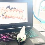 caméra vision 3D de la bouche par les dentistes du cabinet dentaire Villedieu-la-Blouère Maine-et-Loire